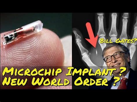 rfid chip implant bill gates|Conspiracy Theory Misinterprets Goals of Gates Foundation.